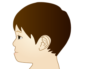受け口 遺伝 骨格の特徴