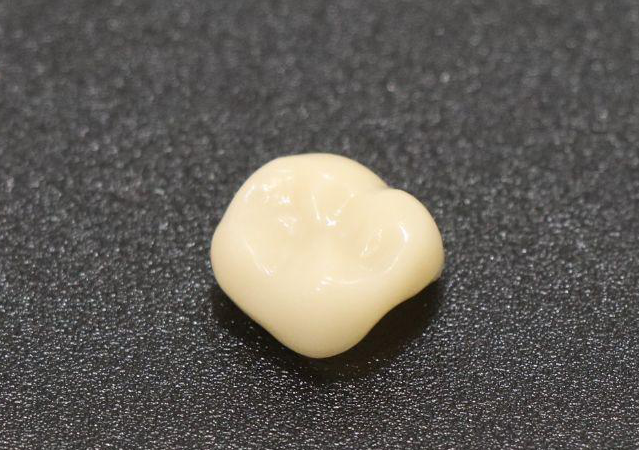 詰め物・かぶせ物 CAD/CAM冠