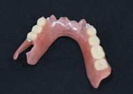 入れ歯　TUMデンチャー