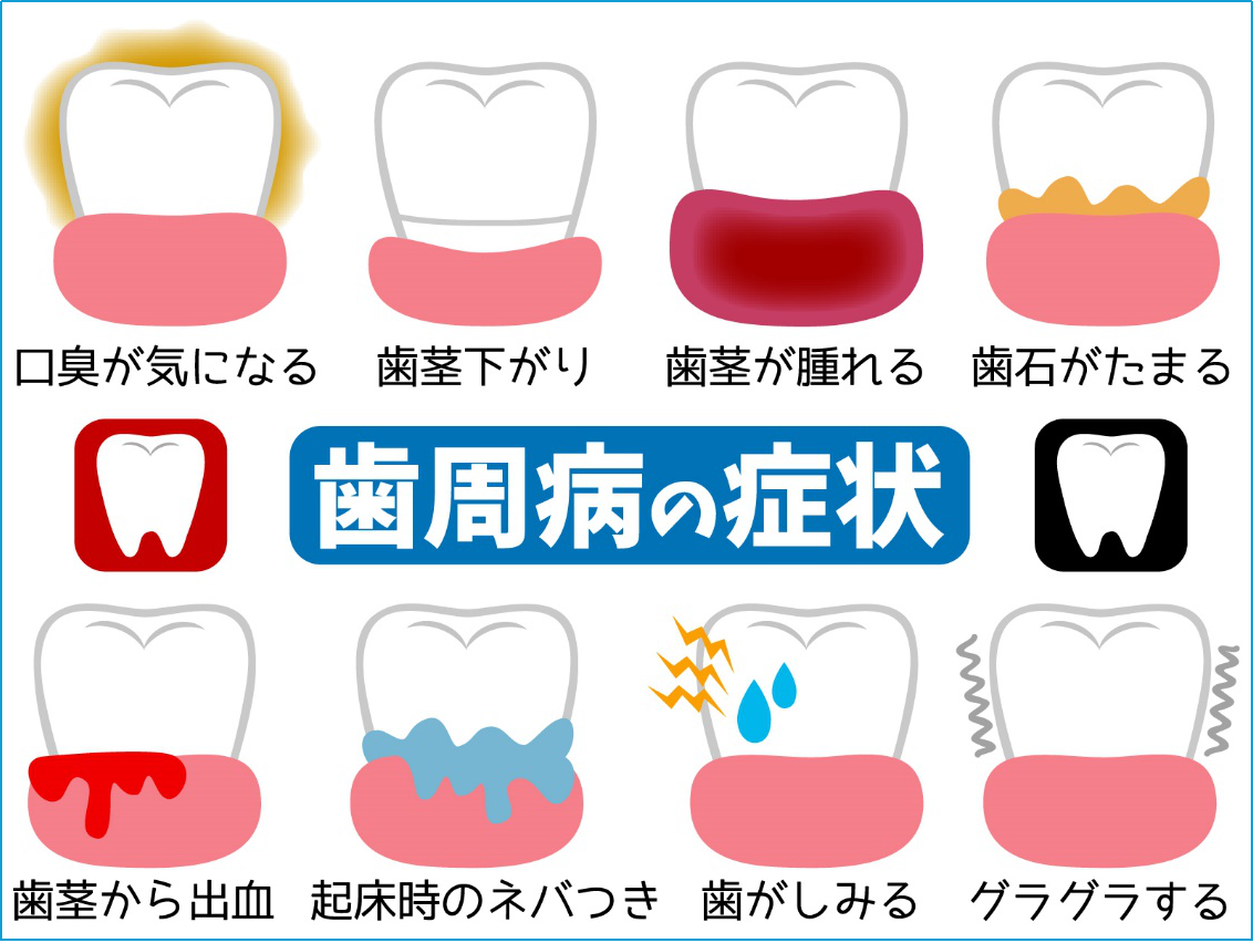 歯周病の症状　口臭　歯ぐき