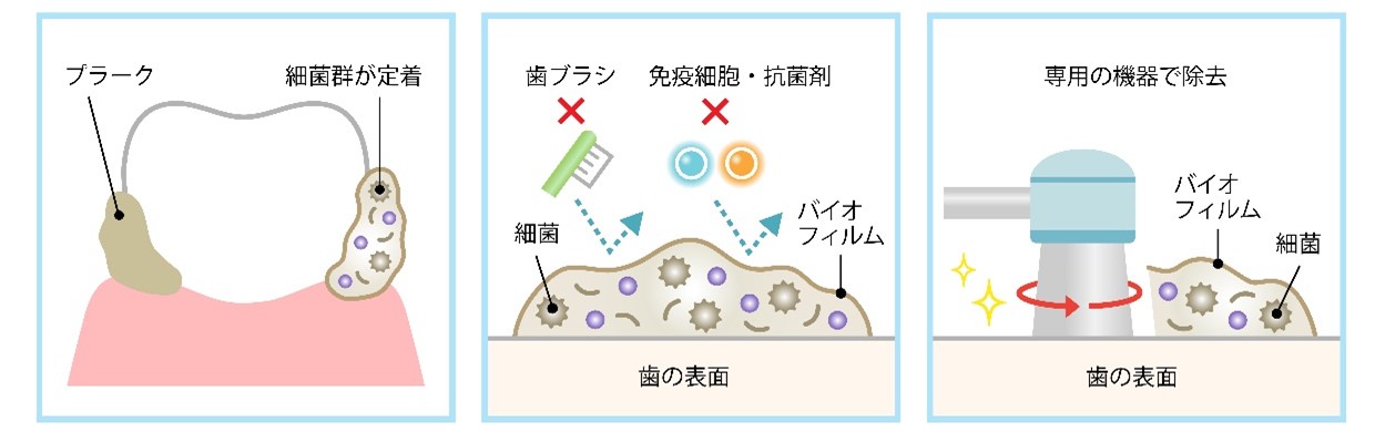 pmtc　バイオフィルム