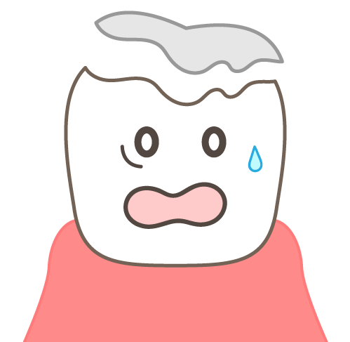 歯　詰め物がとれた　原因