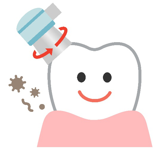 歯 クリーニング PMTC
