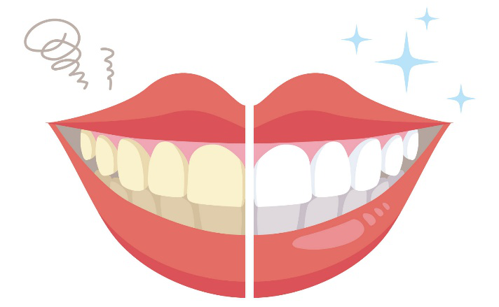 白い歯 ホワイトニング 笑顔