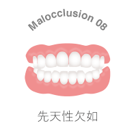 先天性欠如とは