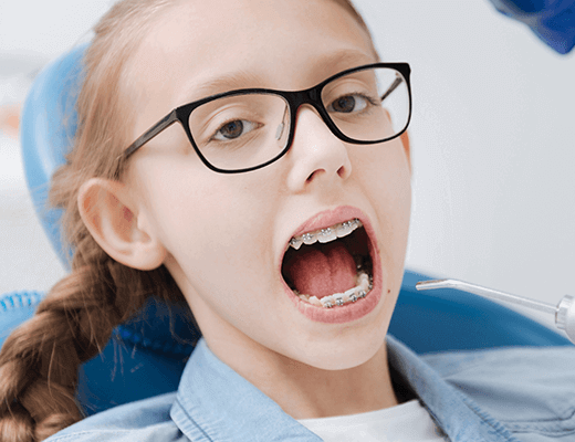 12歳以降の矯正治療(二期治療)・中高生からの矯正治療｜子どもの