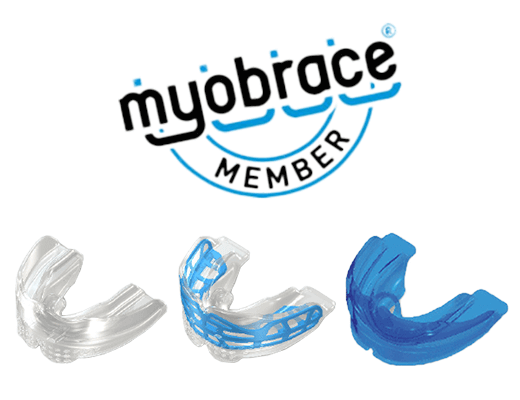 マイオブレース