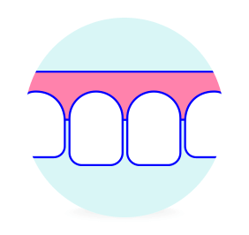 軽度のすきっ歯