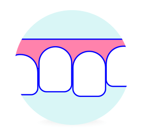 軽度のガタガタした歯並び