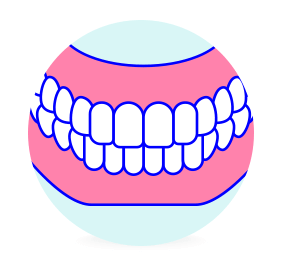 深い咬み合わせ