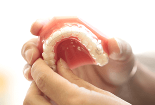 マウスピース矯正装置がついた歯の模型