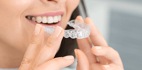 マウスピースを装着する口元