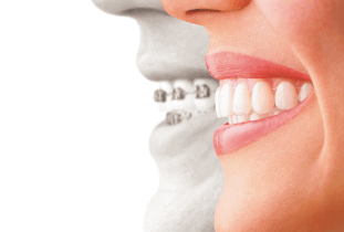 マウスピースを持つ手