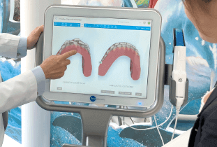 マウスピースを装着する口元