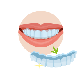 マウスピースを装着する口元